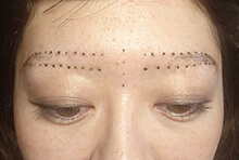 アートメイク眉