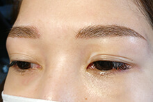 アートメイク眉