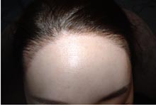 アートメイク眉