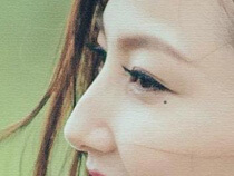 アートメイクほくろ